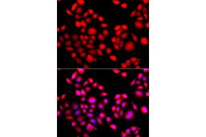 Immunofluorescence analysis of A549 cell using PRDM14 antibody. (PRDM14 抗体)