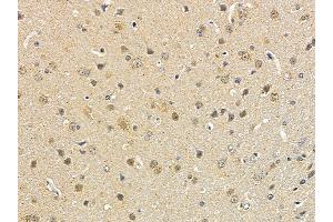 ABIN6258946 and ABIN6274560 at 1/100 staining rat brain tissue by IHC-P. (Spindlin 1 抗体  (N-Term))