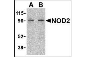 Western blot analysis of NOD2 in HeLa cell lysate with this product at (A) 2 and (B) 4 μg/ml.