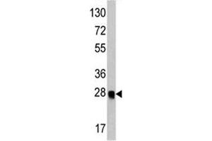 Western blot analysis of ATG12 antibody and recombinant protein. (ATG12 抗体)