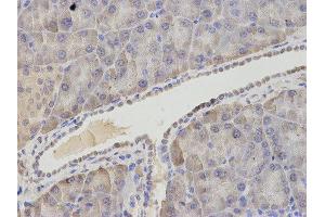Immunohistochemistry (IHC) image for anti-Asparagine Synthetase (ASNS) antibody (ABIN1876738) (Asparagine Synthetase 抗体)