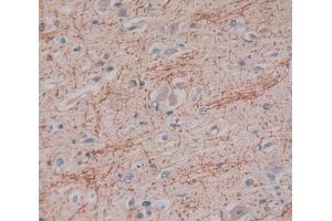 Used in DAB staining on fromalin fixed paraffin- embedded Kidney tissue (IFNA2 抗体  (AA 24-192))