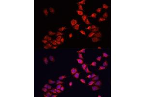 Immunofluorescence analysis of HeLa cells using BNIP3 antibody (ABIN6127502, ABIN6137620, ABIN6137621 and ABIN6221337) at dilution of 1:100. (BNIP3 抗体  (AA 1-164))