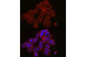 Immunofluorescence analysis of MCF7 cells using TYK2 Rabbit pAb (ABIN3022987, ABIN3022988, ABIN3022989 and ABIN6219333) at dilution of 1:150 (40x lens).