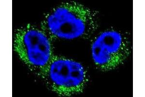 Immunofluorescence (IF) image for anti-Adaptor-Related Protein Complex 1, mu 1 Subunit (AP1M1) antibody (ABIN2996504)