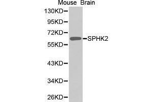 Western Blotting (WB) image for anti-Sphingosine Kinase 2 (SPHK2) (AA 1-165) antibody (ABIN1682869) (SPHK2 抗体  (AA 1-165))