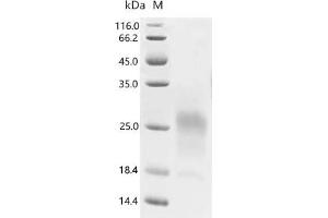 (Tris-Glycine gel) Discontinuous SDS-PAGE (reduced) with 5 % enrichment gel and 15 % separation gel.