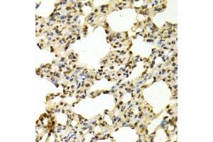 Immunohistochemistry of paraffin-embedded rat lung using PADI4 antibody (ABIN5970978) at dilution of 1/100 (40x lens).