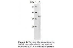 Image no. 2 for anti-Insulin-Like Growth Factor 1 Receptor (IGF1R) antibody (ABIN232138) (IGF1R 抗体)