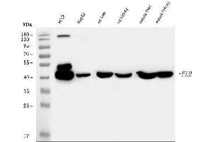 Western blot analysis of FAA/FAH using anti-FAA/FAH antibody (ABIN7599291).