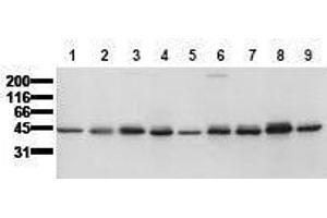 Western Blotting (WB) image for anti-Casein Kinase 1, epsilon (CSNK1E) (AA 355-380) antibody (ABIN126752) (CK1 epsilon 抗体  (AA 355-380))