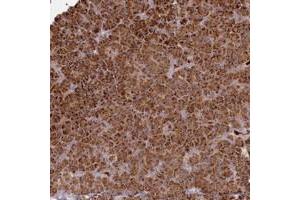 Immunohistochemical staining of human pancreas with BPIFC polyclonal antibody  shows strong cytoplasmic positivity in exocrine glandular cells. (BPIFC 抗体)