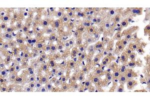 Detection of CASP3 in Mouse Liver Tissue using Polyclonal Antibody to Caspase 3 (CASP3) (Caspase 3 抗体  (AA 29-175))