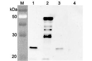 Western blot analysis using anti-FGF-21 (mouse), pAb  at 1:4'000 dilution. (FGF21 抗体)
