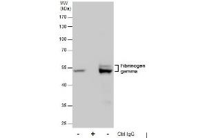 IP Image Immunoprecipitation of Fibrinogen gamma protein from HepG2 whole cell extracts using 5 μg of Fibrinogen gamma antibody, Western blot analysis was performed using Fibrinogen gamma antibody, EasyBlot anti-Rabbit IgG  was used as a secondary reagent. (FGG 抗体)