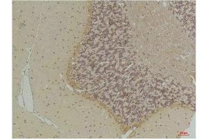 Immunohistochemical analysis of paraffin-embedded Rat BrainTissue using GABA Transporter 1 Rabbit pAb diluted at 1:200. (SLC6A1 抗体)