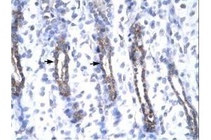Image no. 2 for anti-Matrix Metallopeptidase 19 (MMP19) (AA 56-105) antibody (ABIN6735807) (MMP19 抗体  (AA 56-105))