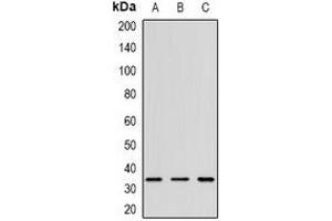 Western blot analysis of CD152 expression in K562 (A), mouse spleen (B), rat thymus (C) whole cell lysates. (CTLA4 抗体)