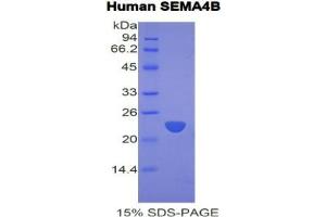 SDS-PAGE analysis of Human Semaphorin 4B Protein. (SEMA4B 蛋白)