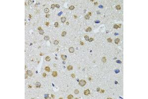 Immunohistochemistry of paraffin-embedded mouse brain using RNASEL antibody. (RNASEL 抗体)