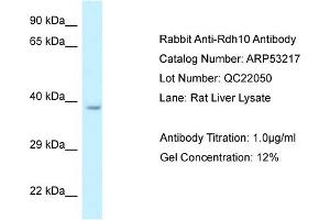 Western Blotting (WB) image for anti-Retinol Dehydrogenase 10 (All-Trans) (RDH10) (C-Term) antibody (ABIN2785295) (RDH10 抗体  (C-Term))