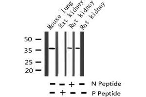 Western blot analysis of Phospho-c-Jun (Thr91) expression in various lysates (C-JUN 抗体  (pThr91))