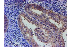 Image no. 1 for anti-Paraneoplastic Antigen MA3 (PNMA3) (AA 1-250) antibody (ABIN1490635) (PNMA3 抗体  (AA 1-250))