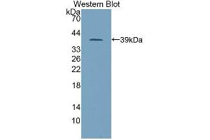 Western blot analysis of the recombinant protein. (PITPNB 抗体  (AA 2-271))
