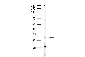 anti-Ribosomal Protein S4, Y-Linked 1 (RPS4Y1) (C-Term) antibody