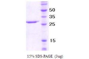 SDS-PAGE (SDS) image for Neutrophil Migration (NM) (AA 22-255) protein (ABIN666806) (Neutrophil Migration (NM) (AA 22-255) 蛋白)