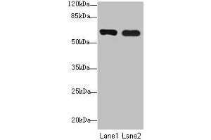 Western blot All lanes: SPTLC3 antibody at 0. (SPTLC3 抗体  (AA 1-58))