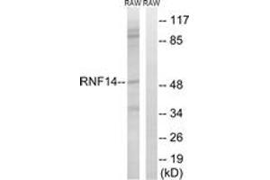 Western blot analysis of extracts from RAW264. (RNF14 抗体  (AA 361-410))