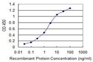 Detection limit for recombinant GST tagged SIX4 is 0. (SIX4 抗体  (AA 672-780))