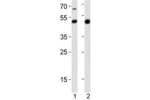 Western blot analysis of lysate from 1) mouse heart and 2) rat stomach tissue lysate using Gata6 antibody at 1:1000. (GATA6 抗体  (C-Term))