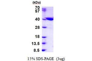 SDS-PAGE (SDS) image for Zinc Binding Alcohol Dehydrogenase Domain Containing 2 (ZADH2) (AA 33-377) protein (His tag) (ABIN6387497)