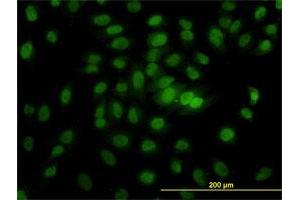 Immunofluorescence of monoclonal antibody to CSE1L on HeLa cell. (Exportin 2 抗体  (AA 872-971))