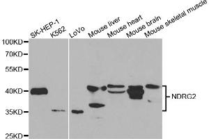 Western blot analysis of extracts of various cell lines, using NDRG2 antibody (ABIN5973062) at 1/1000 dilution. (NDRG2 抗体)