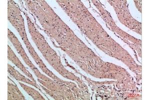 anti-Phosphoinositide 3 Kinase, p85 beta (PI3K p85b) (AA 1-60) antibody