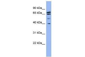 WB Suggested Anti-SH3GL2 Antibody Titration: 0. (SH3G2 抗体  (Middle Region))
