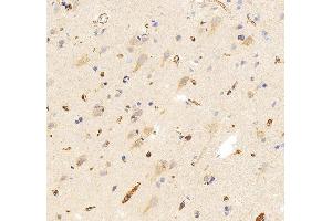 IHC analysis of SLC25A13 using anti-SLC25A13 antibody (ABIN7599512). (slc25a13 抗体  (AA 1-643))