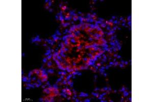 Immunofluorescence of paraffin embedded rat lung using ARHGAP18 (ABIN7075417) at dilution of 1: 700 (400x lens) (ARHGAP18 抗体)