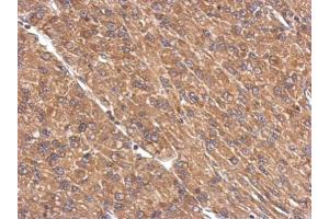 IHC-P Image Immunohistochemical analysis of paraffin-embedded U87 xenograft, using PPP2R1A, antibody at 1:500 dilution. (PPP2R1A 抗体  (Center))