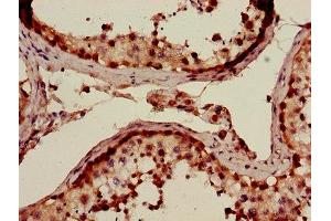 Immunohistochemistry of paraffin-embedded human testis tissue using ABIN7143044 at dilution of 1:100 (ABLIM3 抗体  (AA 266-544))