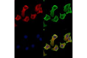 ABIN6264961 and ABIN6279698 staining Hela cells by IF/ICC. (SEC61B 抗体  (N-Term))