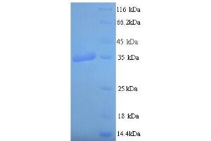 SDS-PAGE (SDS) image for PDZ and LIM Domain 7 (Enigma) (PDLIM7) (AA 185-386) protein (His tag) (ABIN5714018) (PDLIM7 Protein (AA 185-386) (His tag))