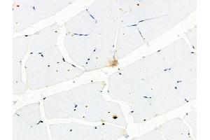 Phospho-YB1 (Ser102) Antibody at 1/100 staining Rat muscle tissue by IHC-P. (YBX1 抗体  (pSer102))