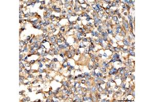 IHC analysis of AP2A2 using anti-AP2A2 antibody (ABIN7602295).