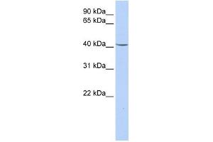 GPD1 antibody used at 1 ug/ml to detect target protein. (GPD1 抗体)