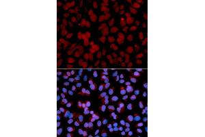 Immunofluorescence analysis of U2OS cell using TNFAIP3 antibody. (TNFAIP3 抗体  (AA 1-190))