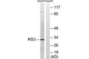 Western blot analysis of extracts from HepG2 cells, using RPS3 Antibody. (RPS3 抗体  (AA 171-220))
